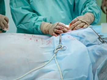 Photo weight loss surgery